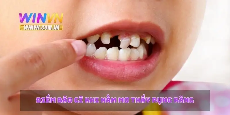 Điềm báo gì khi nằm mơ thấy rụng răng